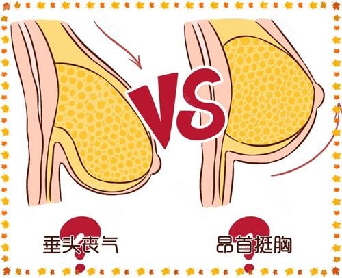 女生怎么擠胸？ 擠壓乳房有什么危害？