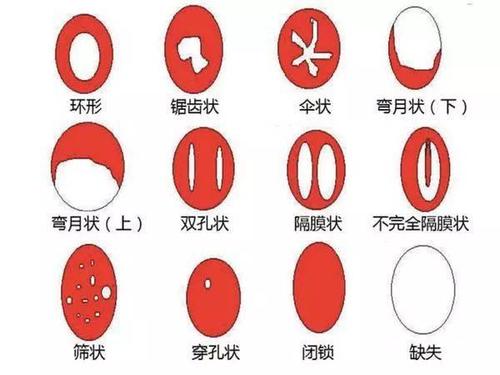 如何解決第一次破處出血？