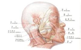 面部神經炎