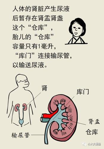 腎積水癥狀,孕婦腎積水癥狀