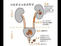 尿道炎是什么癥狀,膀胱尿道炎是什么癥狀