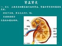 腎盂腎炎癥狀_腎盂腎炎癥狀與治療