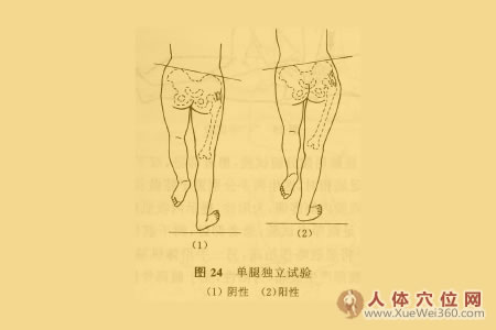 單腿獨立試驗