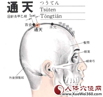 通天穴位位置圖