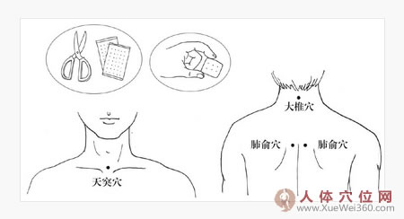 巧用膏藥敷穴位，止咳平喘見效快